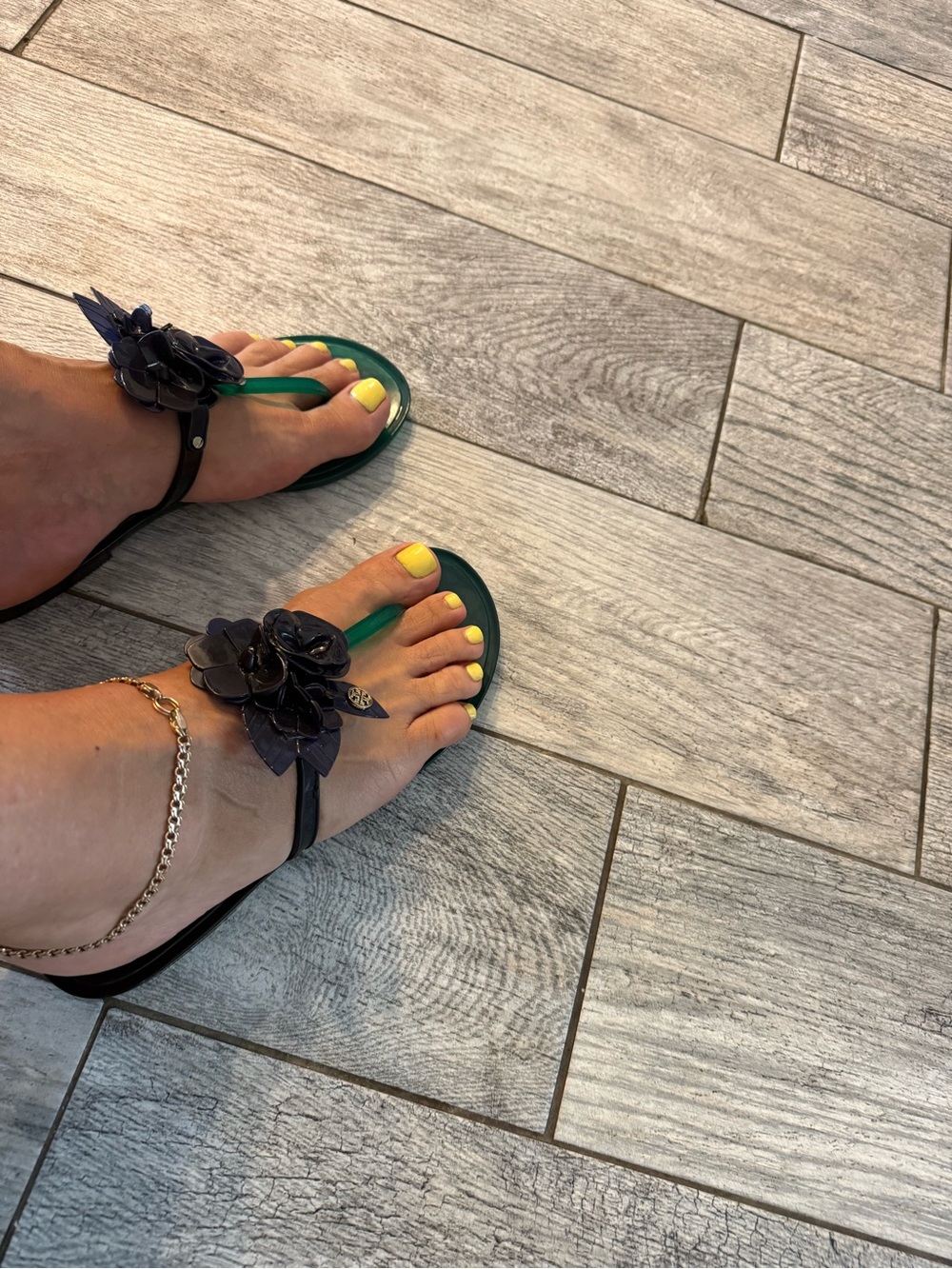 Tory Burch Dark Green Jelly Floral Thong Sandals with Navy Accents - Picture 4 of 6